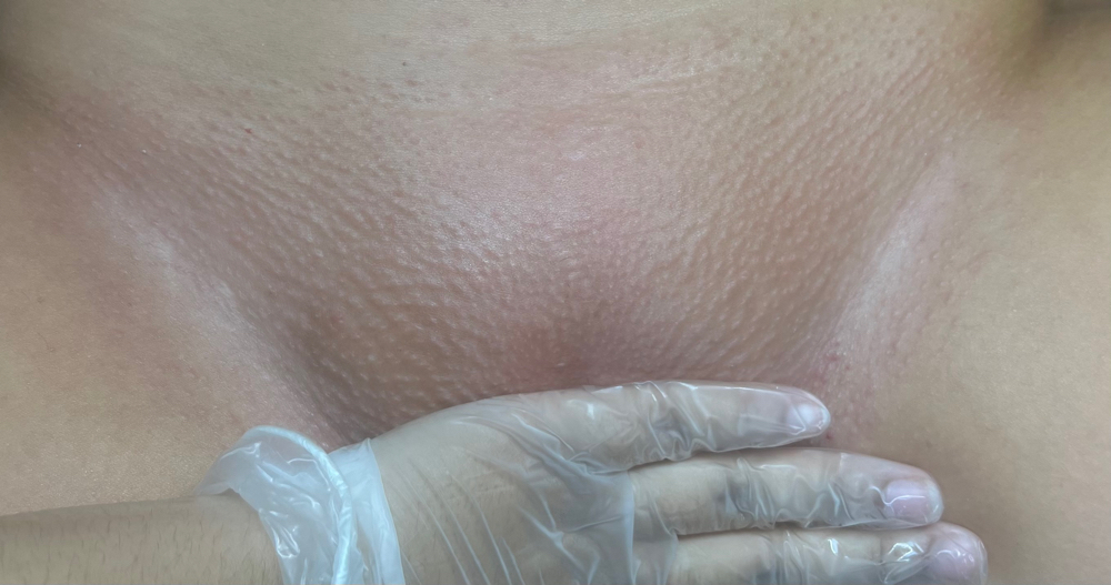 Brazilian Wax