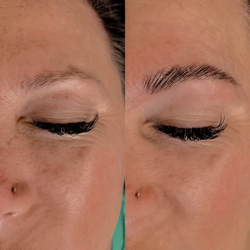 Brow Lamination