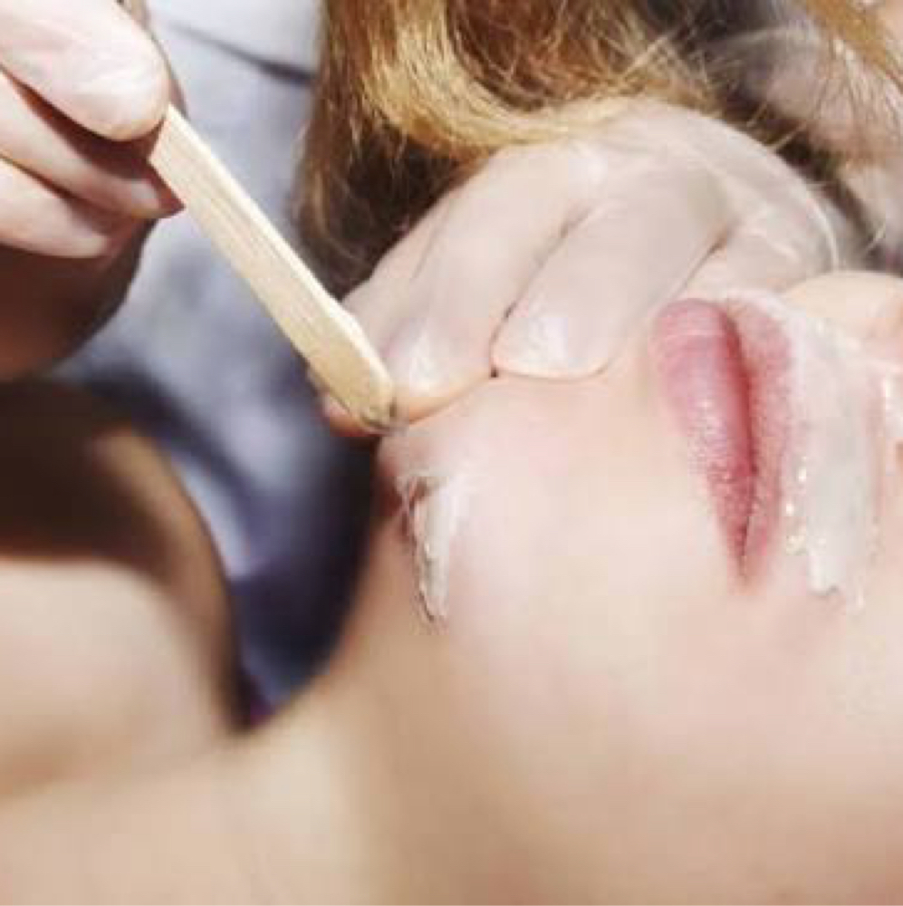 Chin Wax at Illuminate Dentistry & Aesthetics in St. Joseph, MO