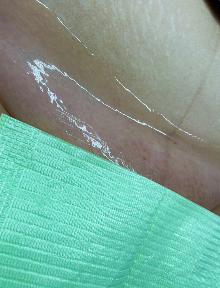 Brazilian w/Hydrojelly mask