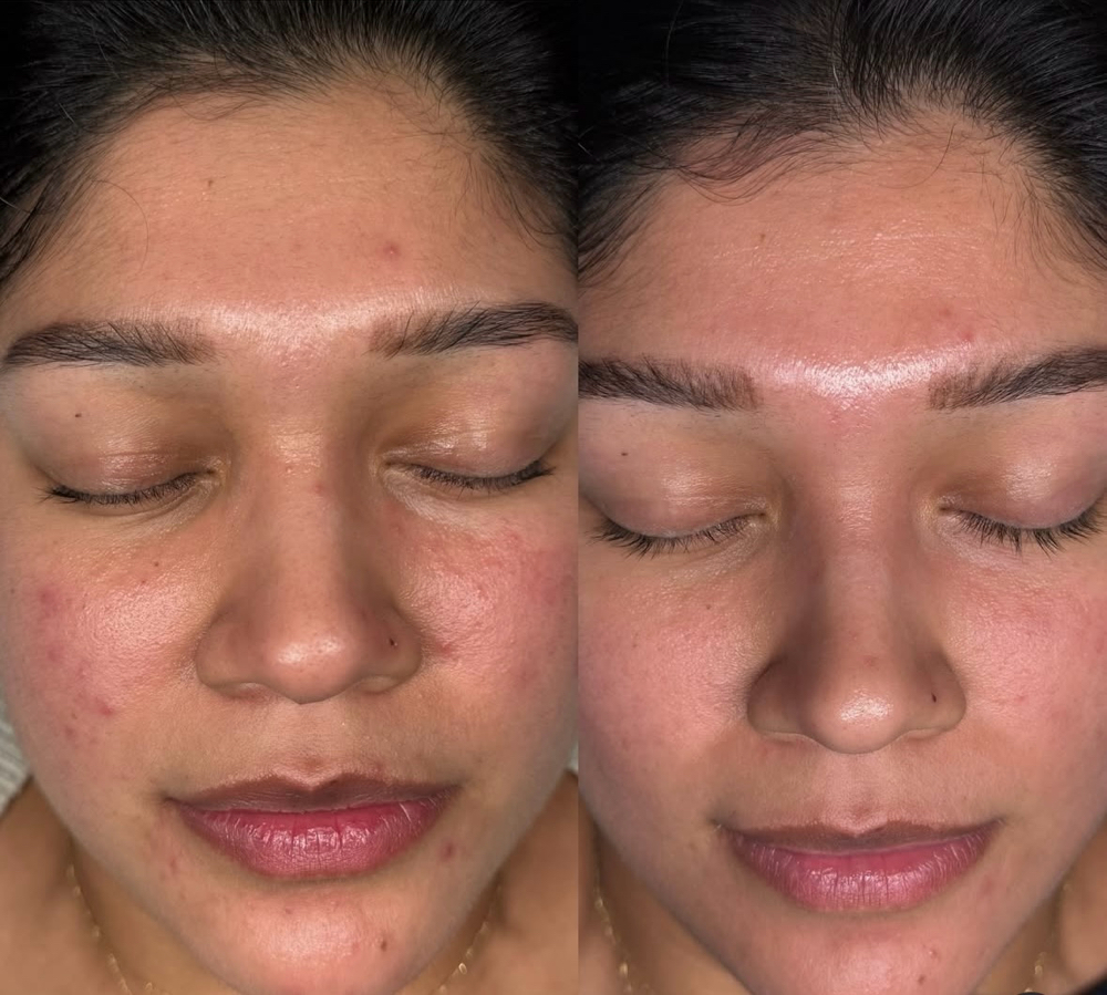 Custom Facial at Glo Skin Space in Crystal, MN