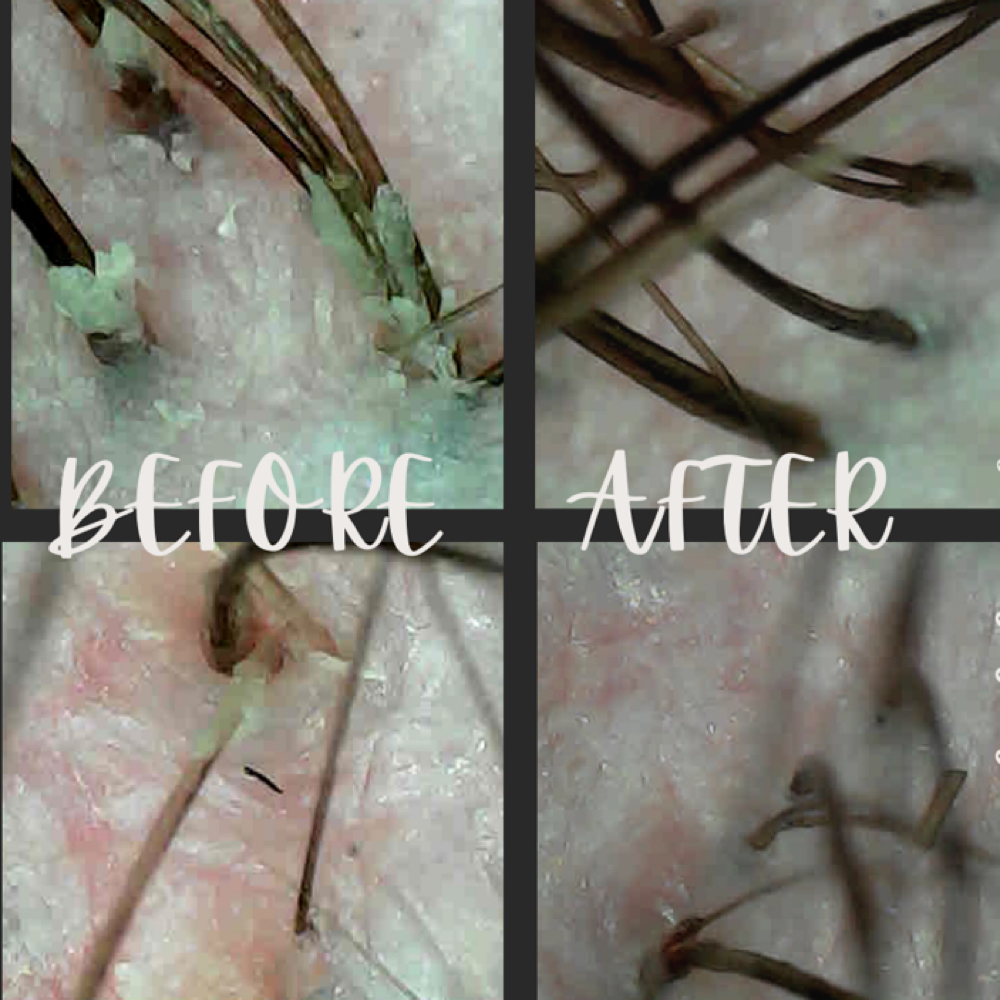 Malibu Headlab Treatment at Blooming Beauty by Kay in Charlotte, MI