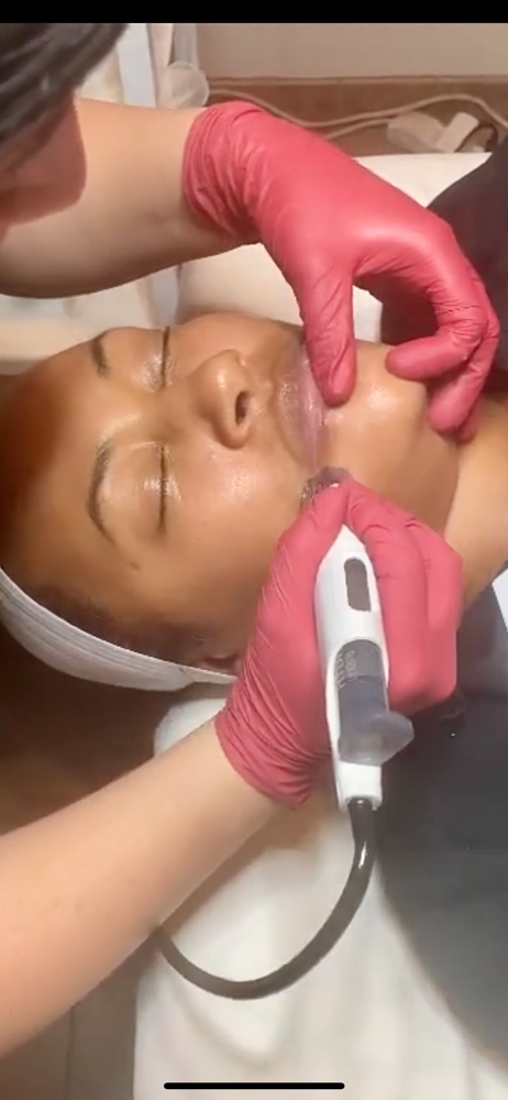 Micro-Infusion Face Treatment