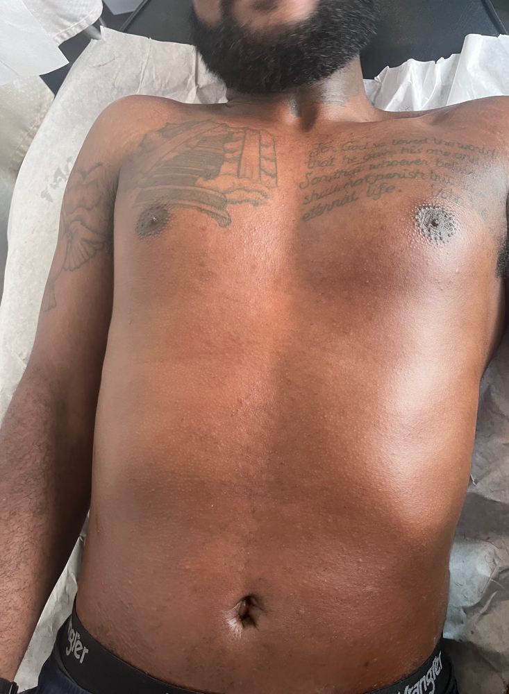 Chest Wax (Full
