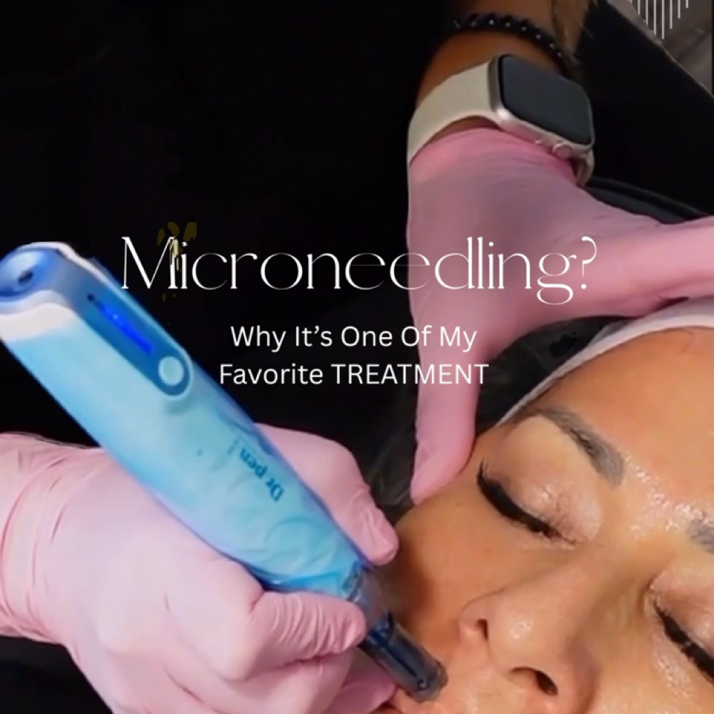 Micro-needling Consultation at TRES Aesthetics in Missouri, TX