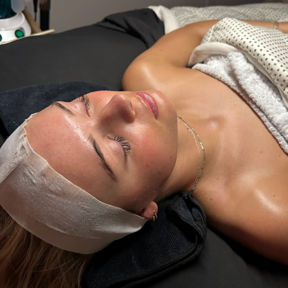 Skin Barrier Repair at Lexibelleskin in St George, UT