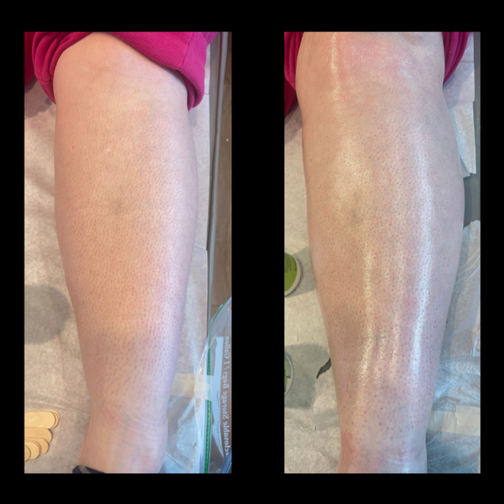 Leg (Half) at Mariangelie  Perales