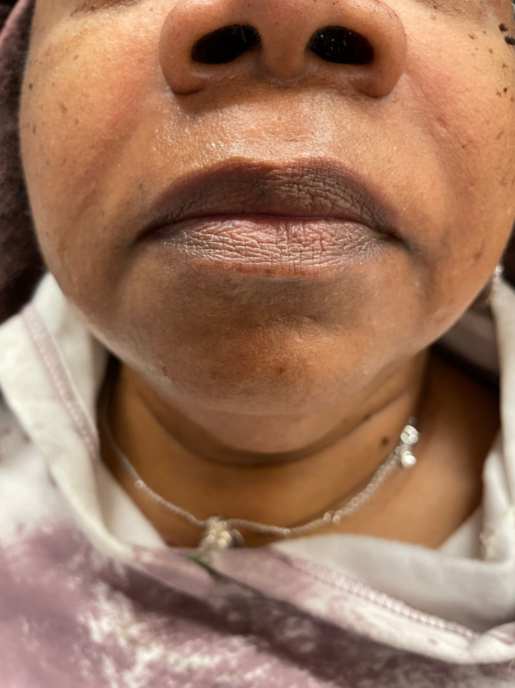 Lip Wax