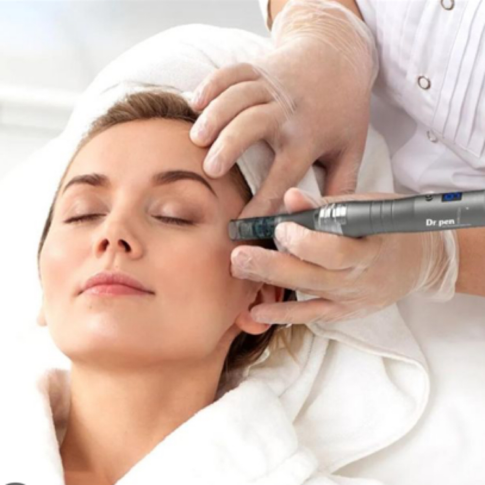 Microneedle Face at Glow On Main in Unadilla, NE