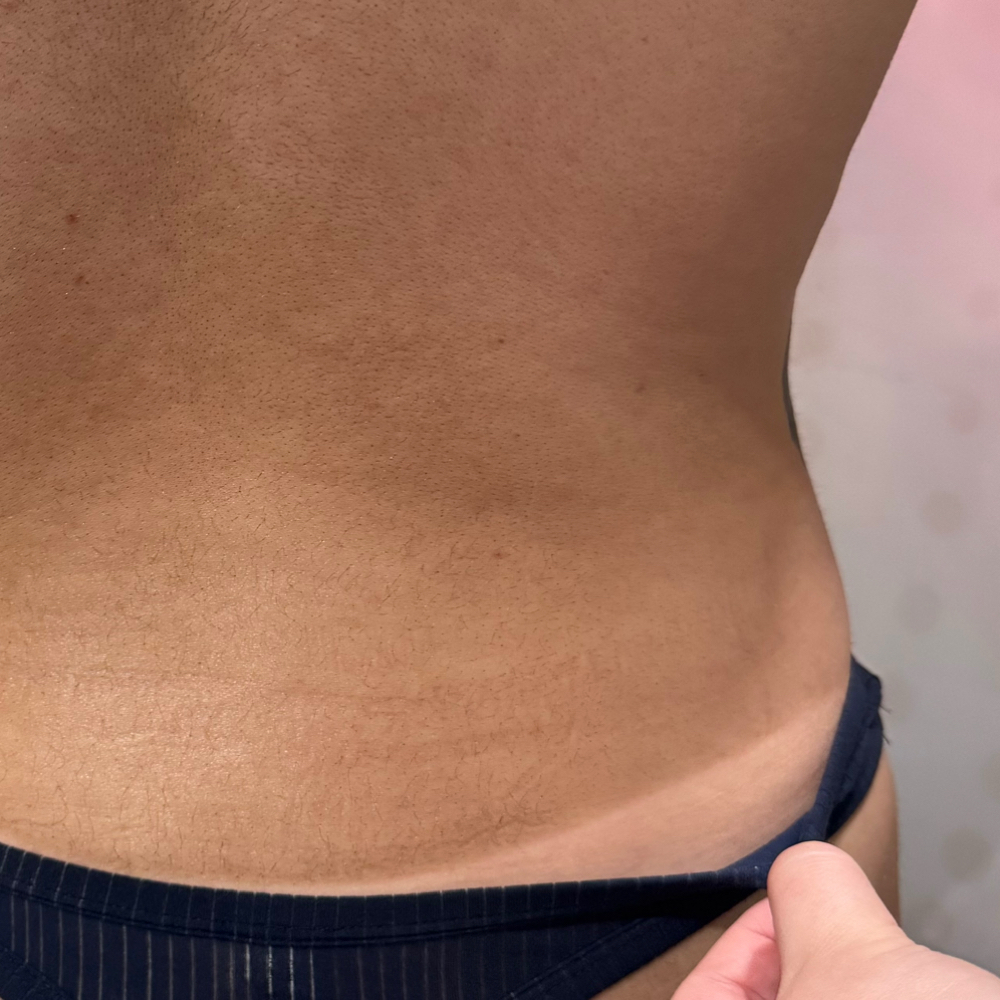 Spray Tan at Crystal Clear Skin by Madison in Sherman, TX