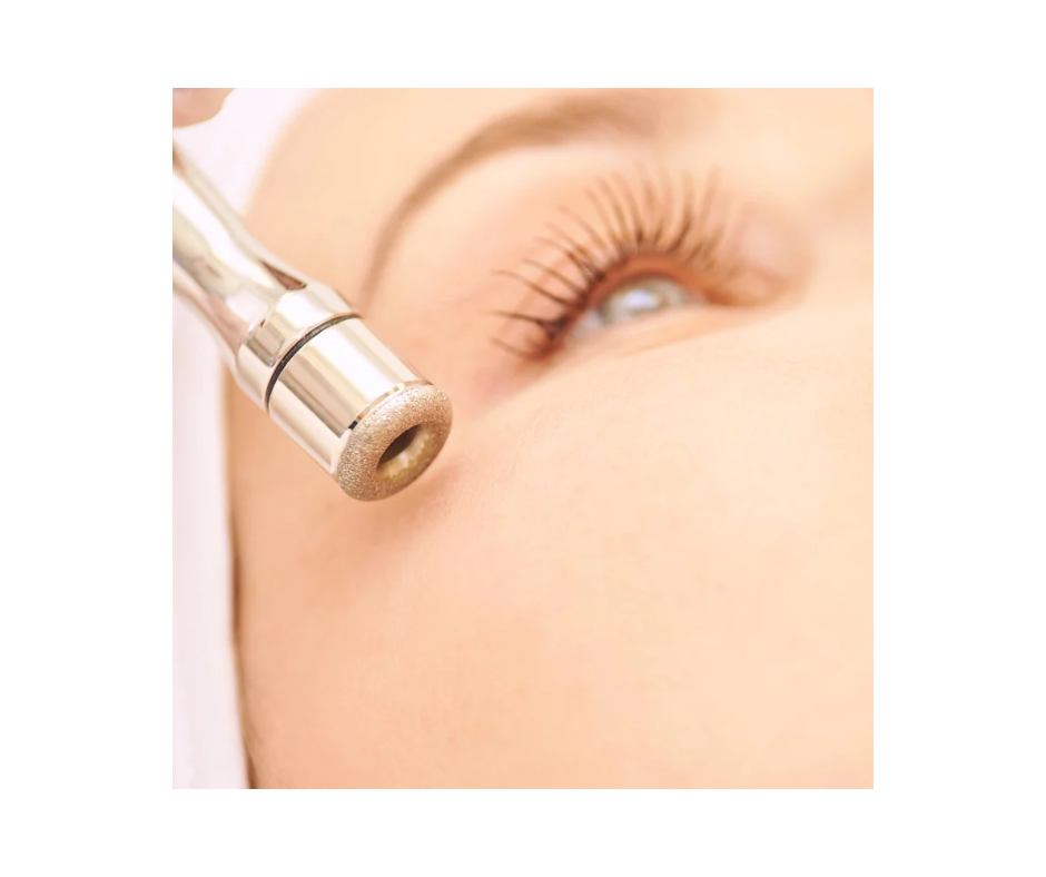 Diamond Microdermabrasion Treatment at Nature Coast Day Spa LLC in Homosassa, FL