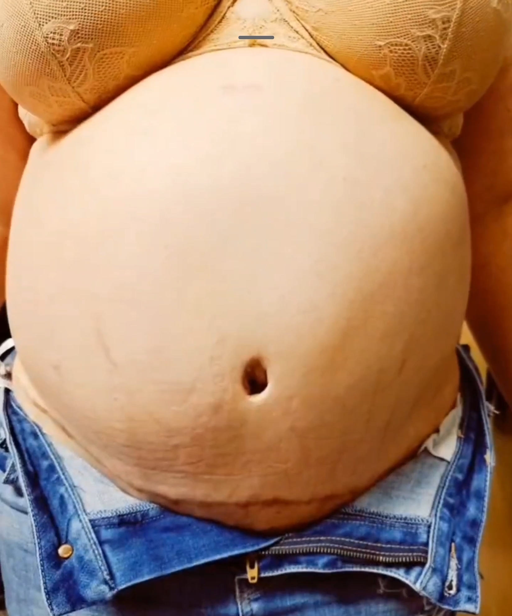 Grasa Viceral at Chio's Reshaping VIP in TEXAS, TX