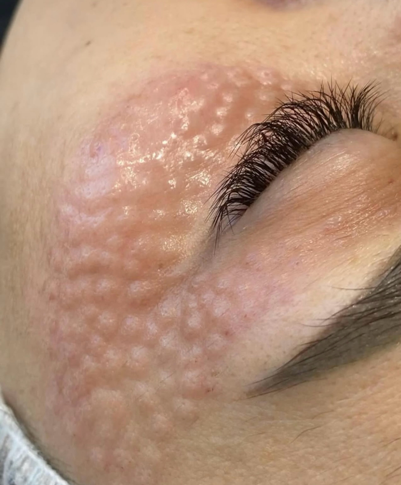 Lumy Eye at Mila Wellness Center in Doral, FL