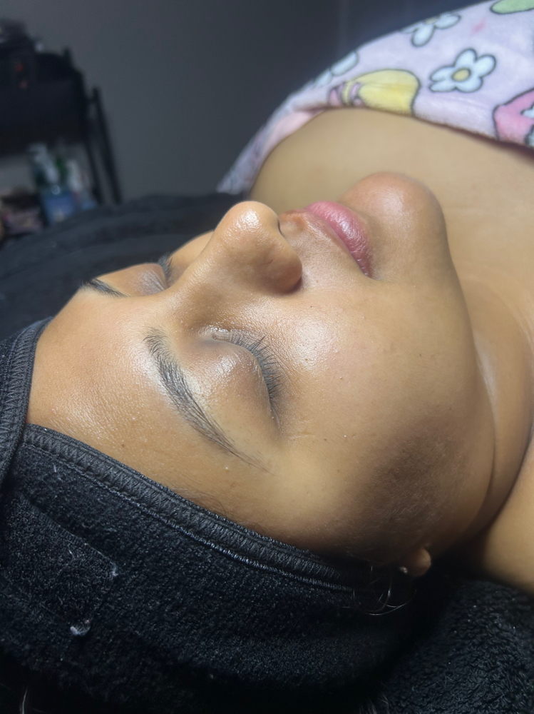 Better Then Botox
