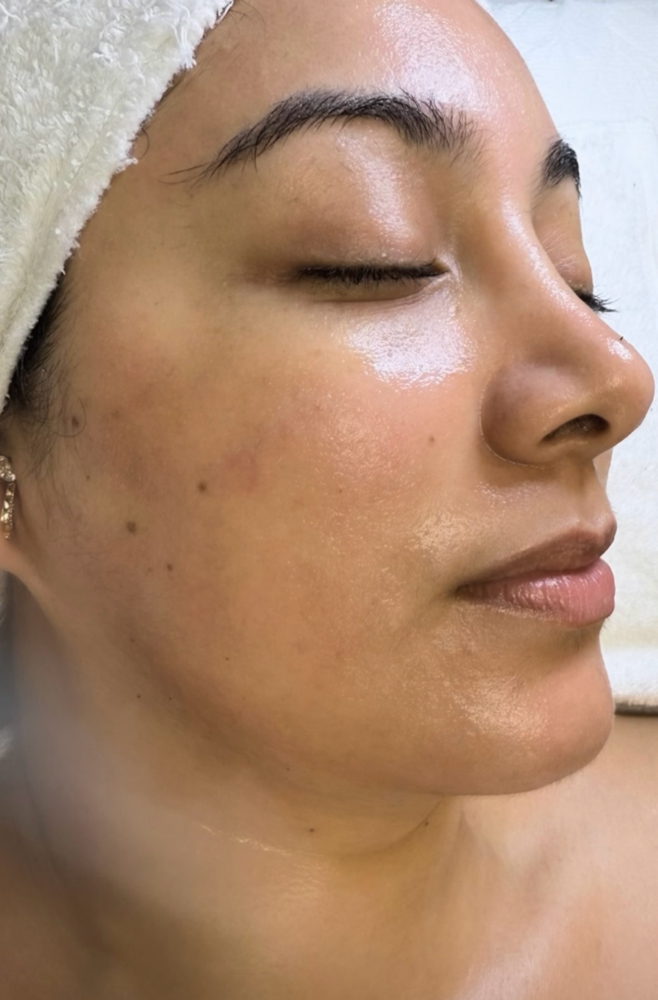 Signature Forever Hydrafacial