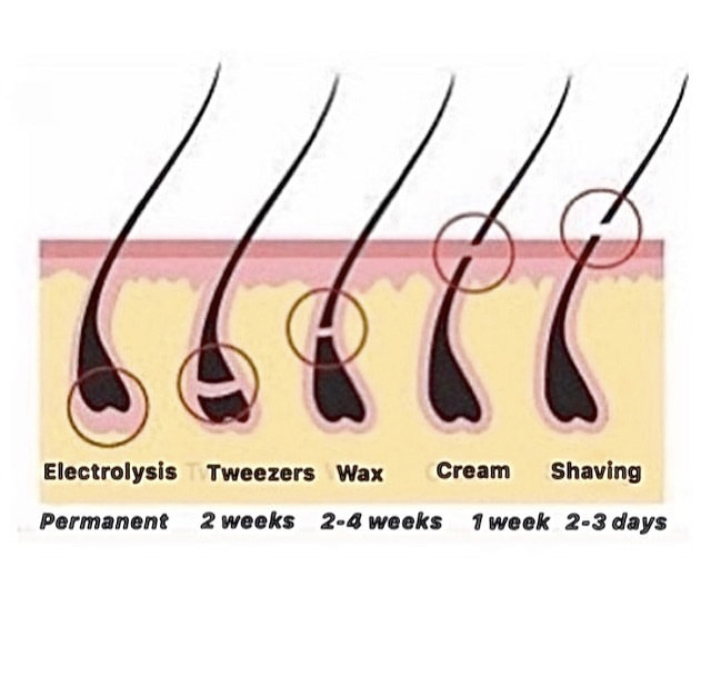 Electrolysis-20min