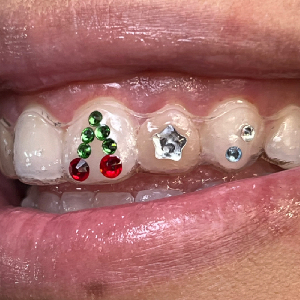 Tooth Gems at Future Sick Tattoos in San Antonio, TX