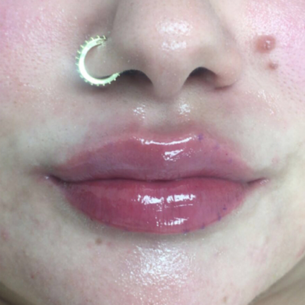 Half Syring Lip Filler Deal$ at DopeGirlz Beauty Spa Academy in Columbus, OH