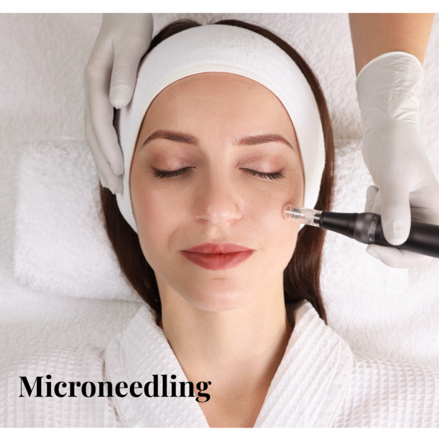 Microneedling at Appalachian Hydration And Wellness in Lewisburg, WV