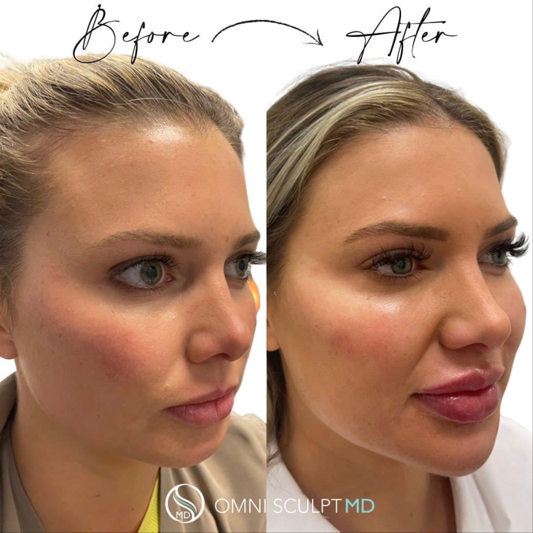 ✨ Tier 3 Balance 5ml at Savage Artistry in melbourne, FL
