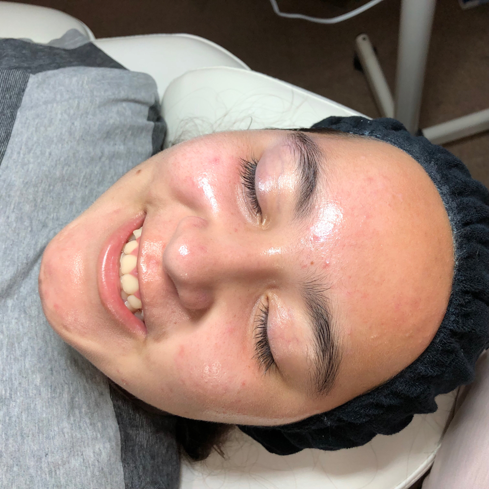 Teen Moisturizing Facial