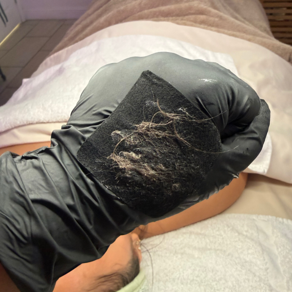 Dermaplane - ADD ON at Flawless Beauty by Sierra in Roseville, CA