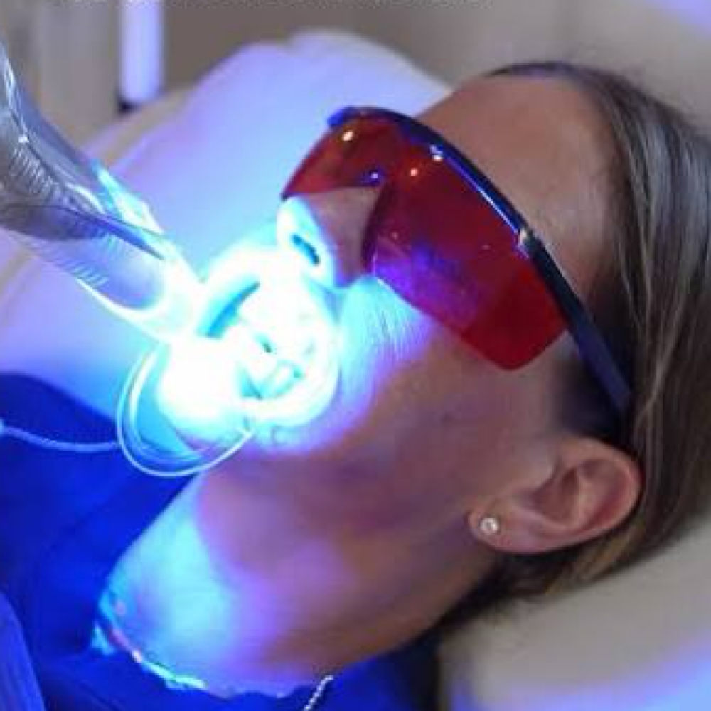 Teeth Whitening at The Boujee Beauty in Burnet, TX