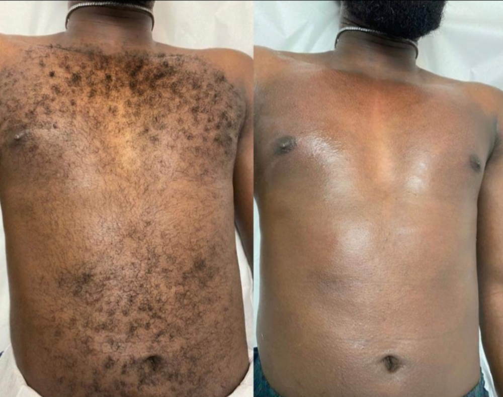 MALE CHEST AND STOMACH