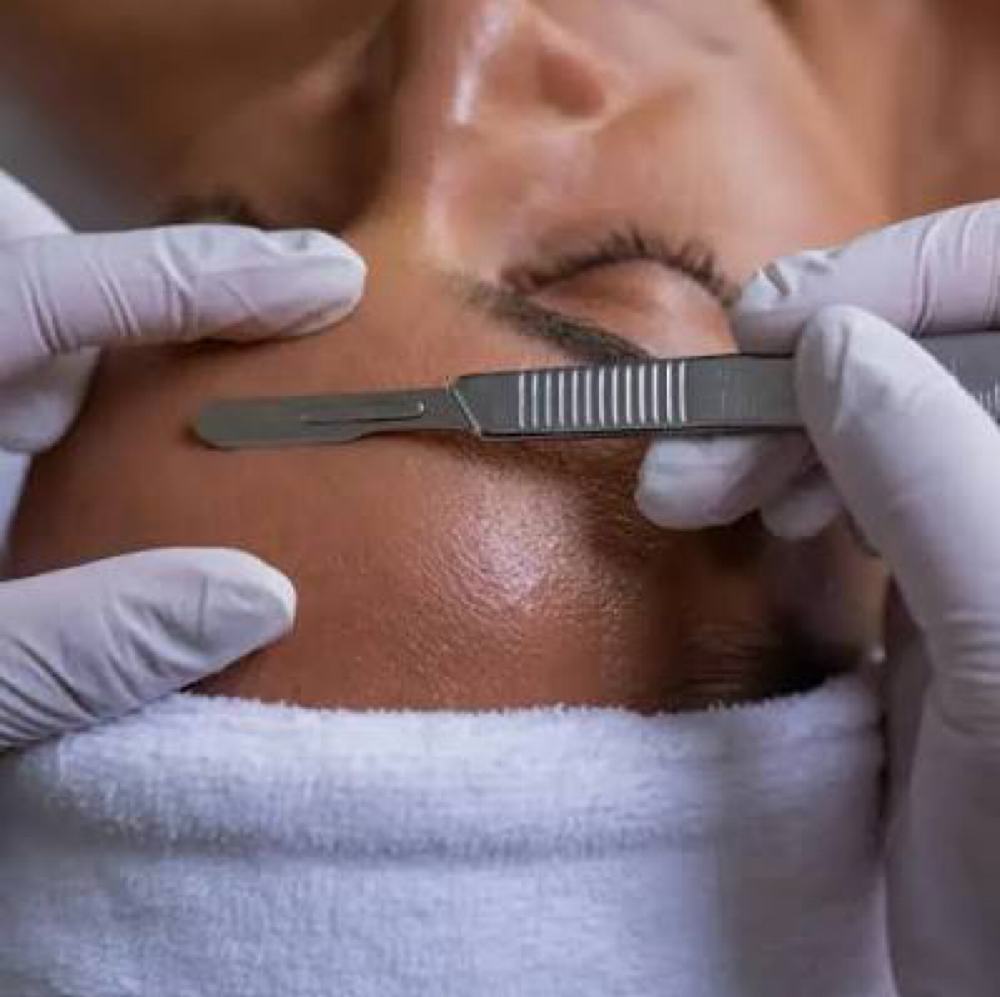 Dermaplain W/ Enzime at Studios Secrets in Dallas, TX