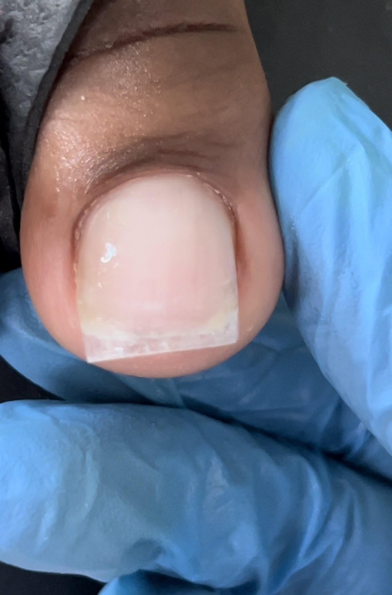 Bestie-Color Change Pedi/BigToe Ex
