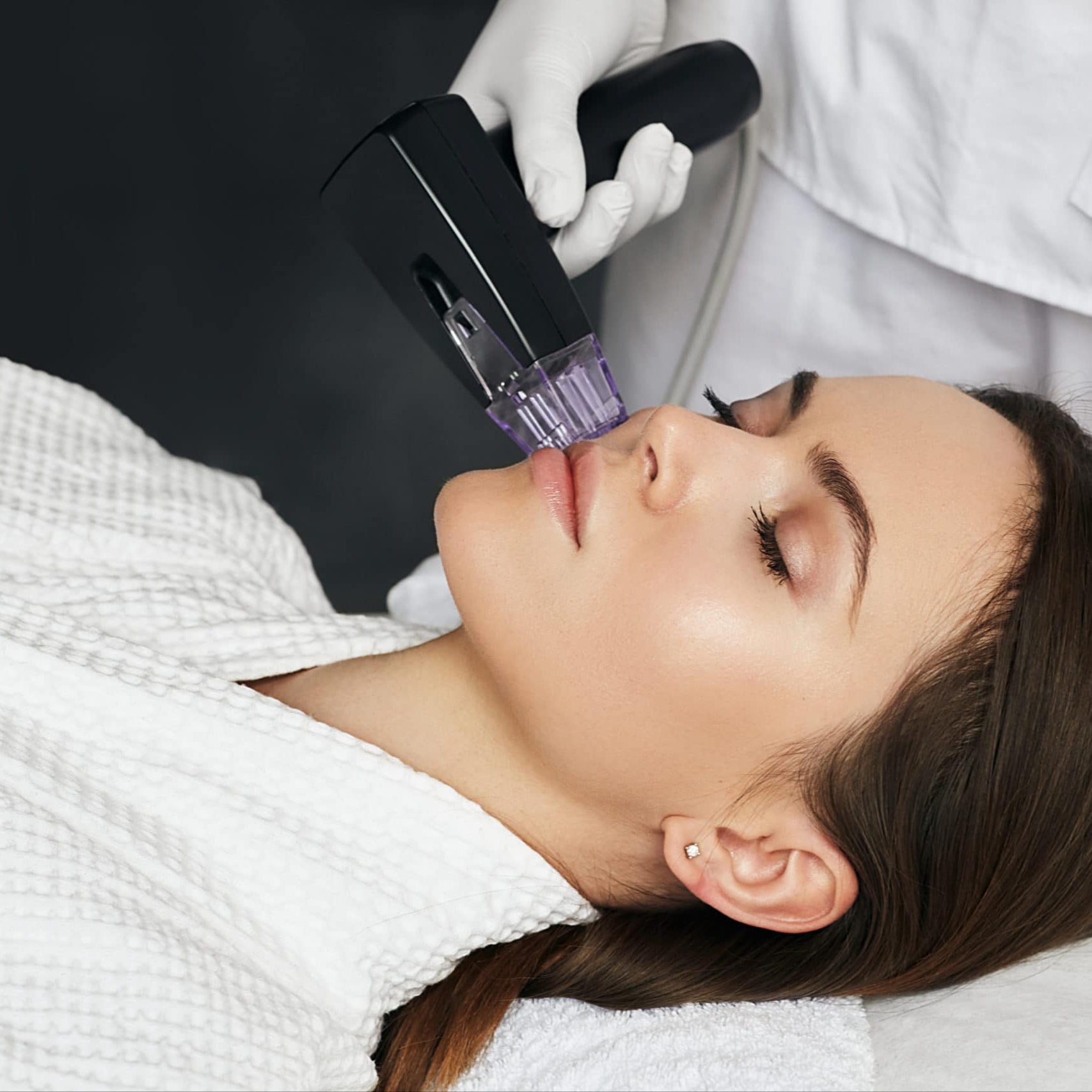 Morpheus 8 (RF Microneedling) at E.V. Aesthetics in Torrance, CA