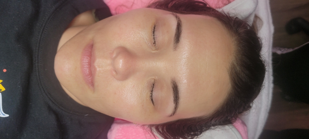 DERMAPLANING FACIAL