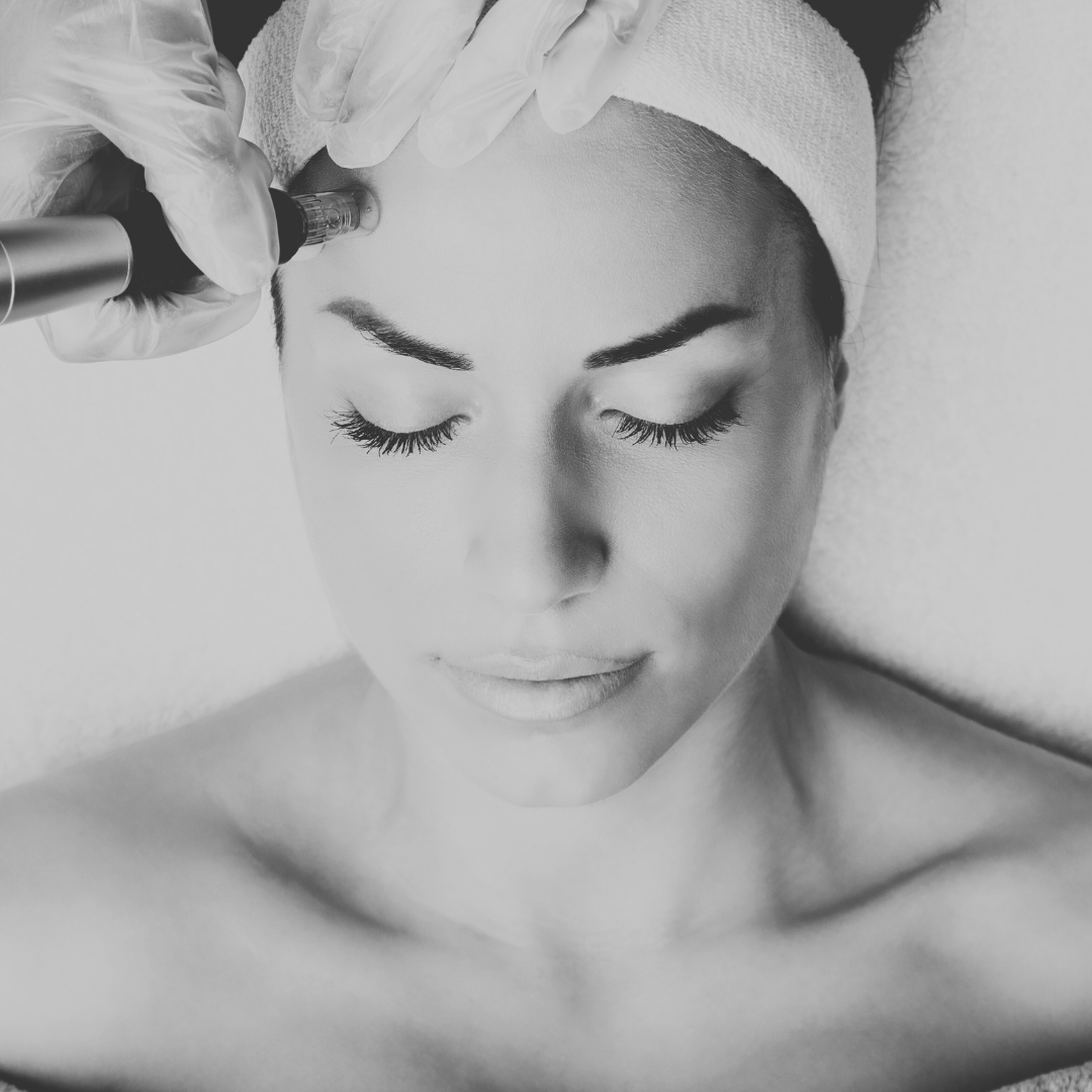 Collagen Induction Therapy