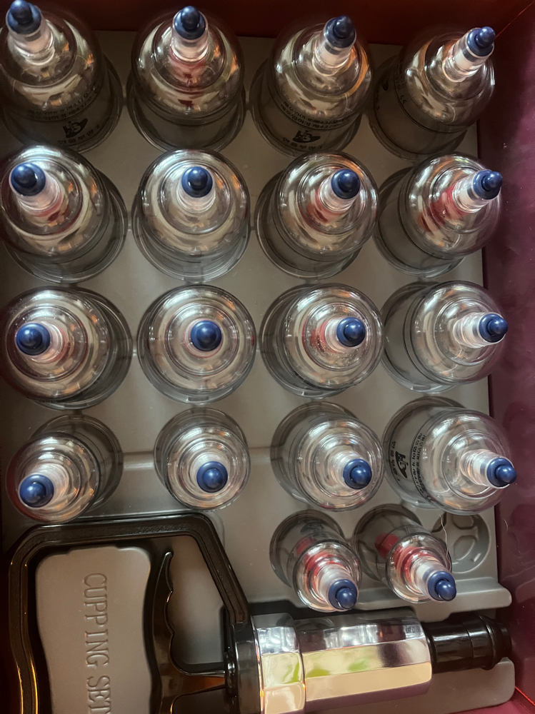 Cupping--Only as an add-on