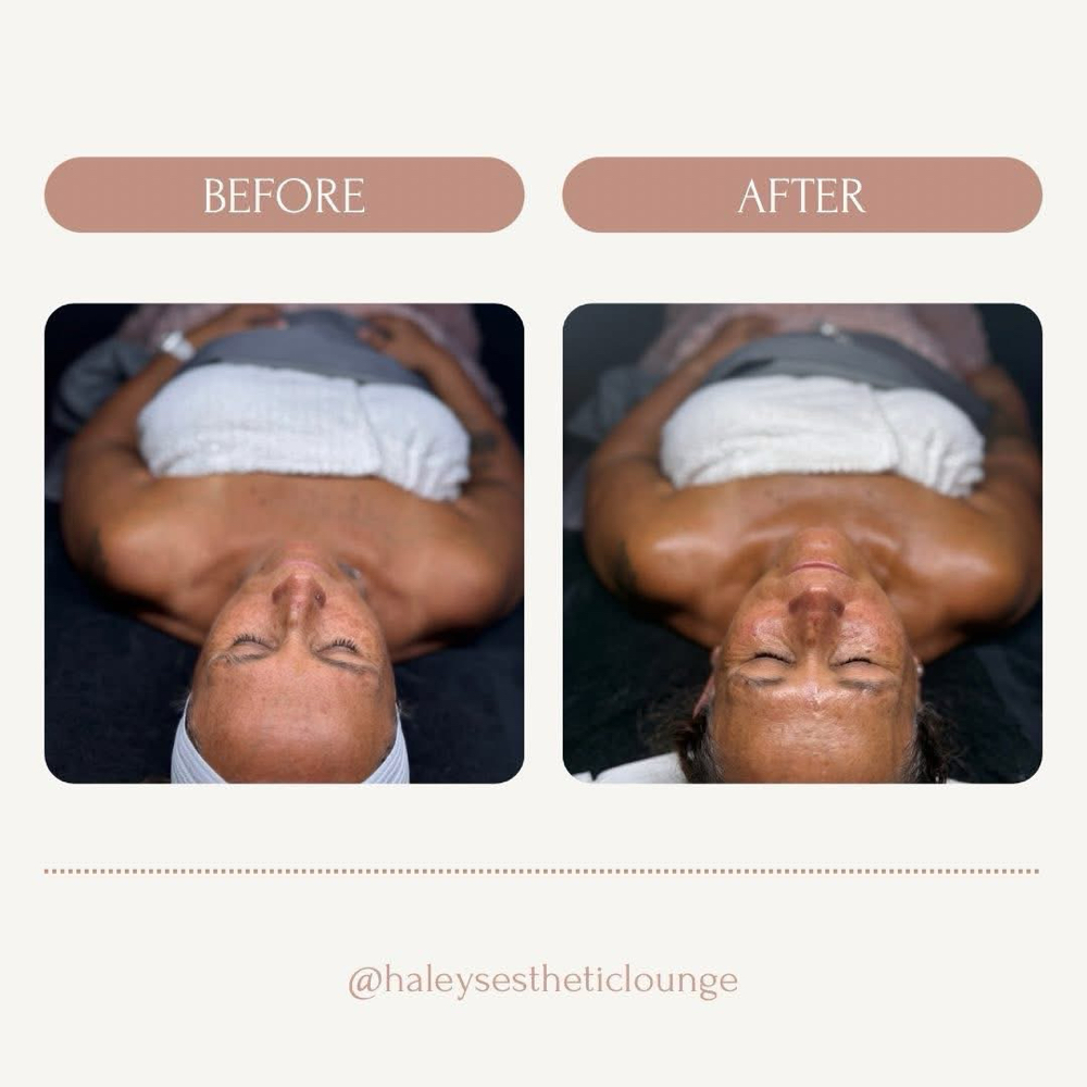 Berry Brightening Facial