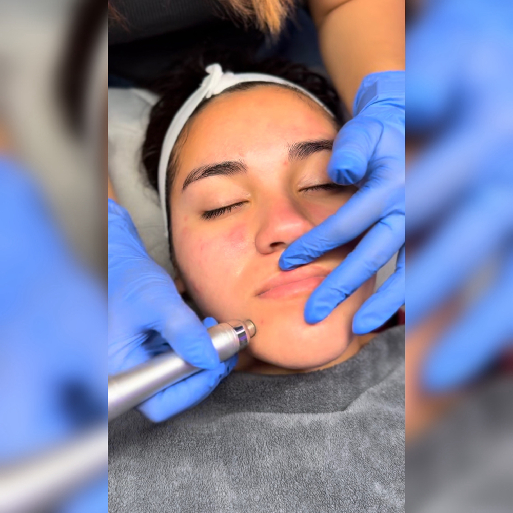 The Luxx Facial ๐ง