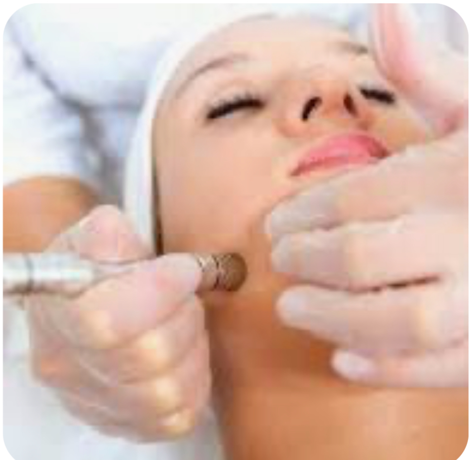 Microdermabrasion Add On W/ChemPeel