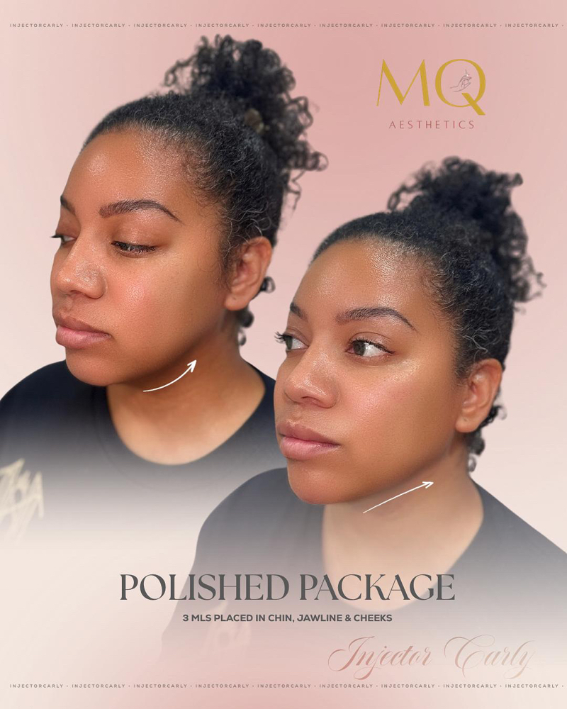 Facial Balancing