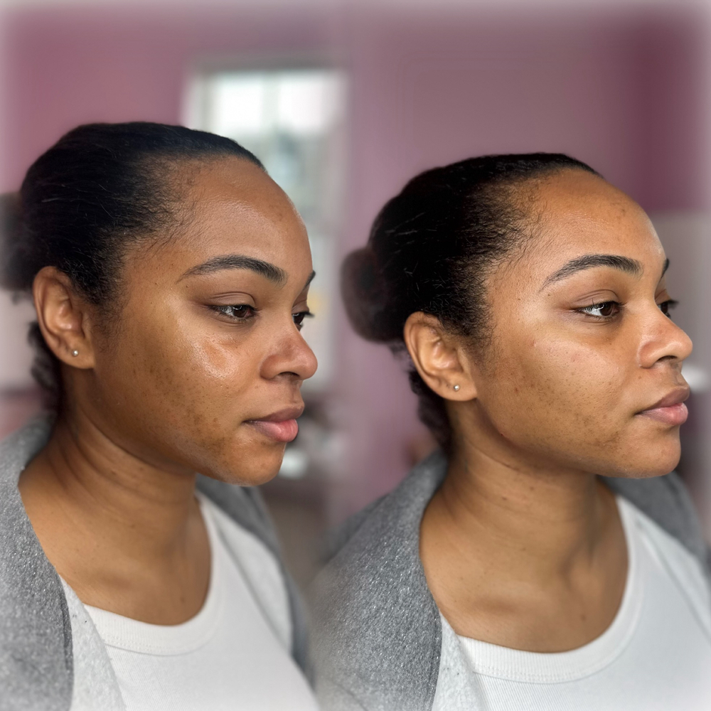 Facial Balancing