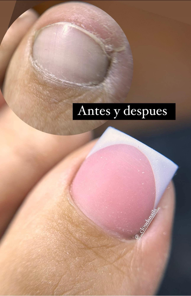 Toe Nails  🌸