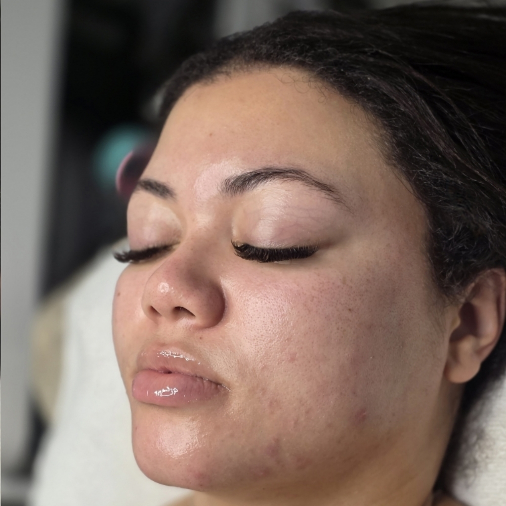 New Clients Start Here! at Grand Amour Esthetics in Las Vegas, NV