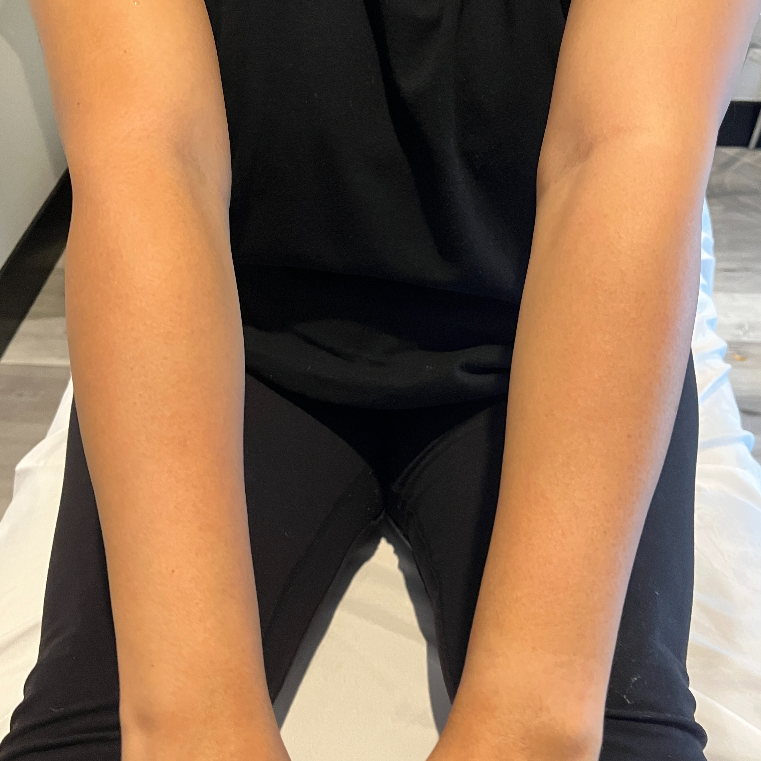 Youth Full Arms at Wellington Skin Studio in Wellington, FL