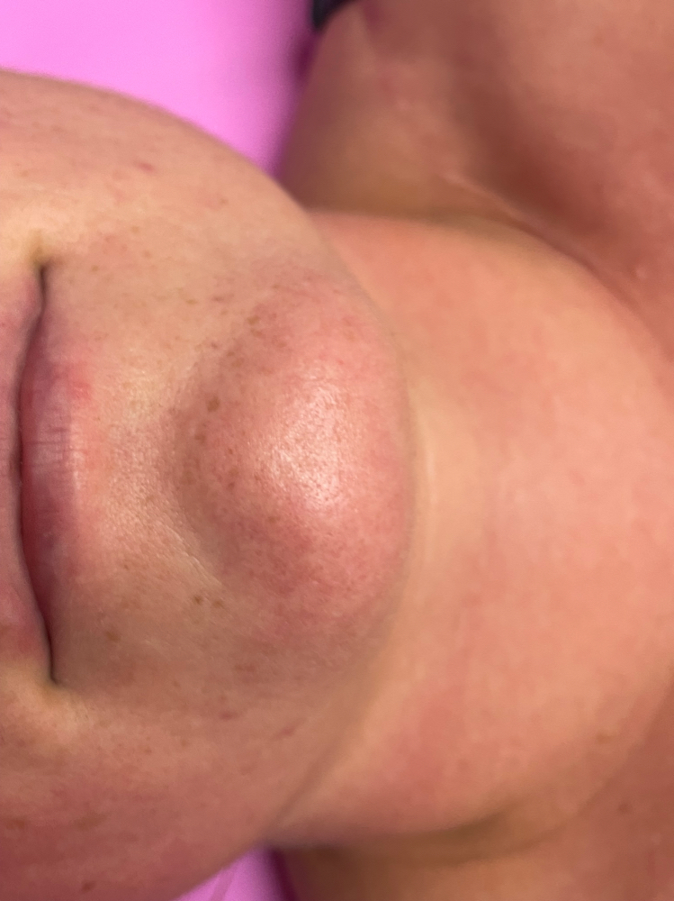 Chin Wax