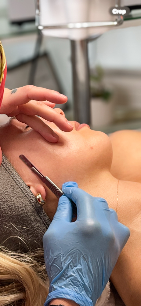 Dermaplaning Facial