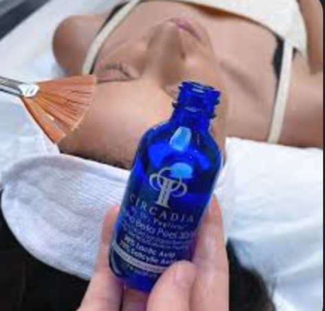 Chemical Peel