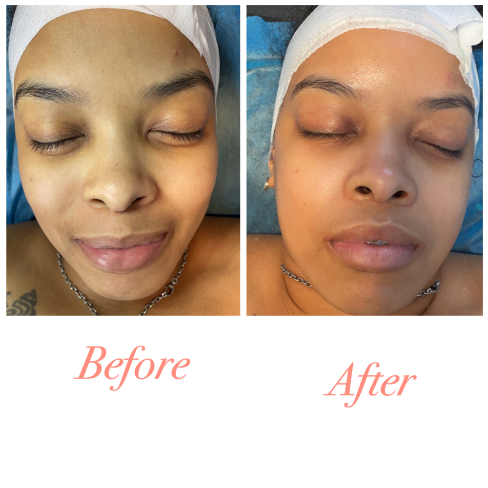 Basic Facial