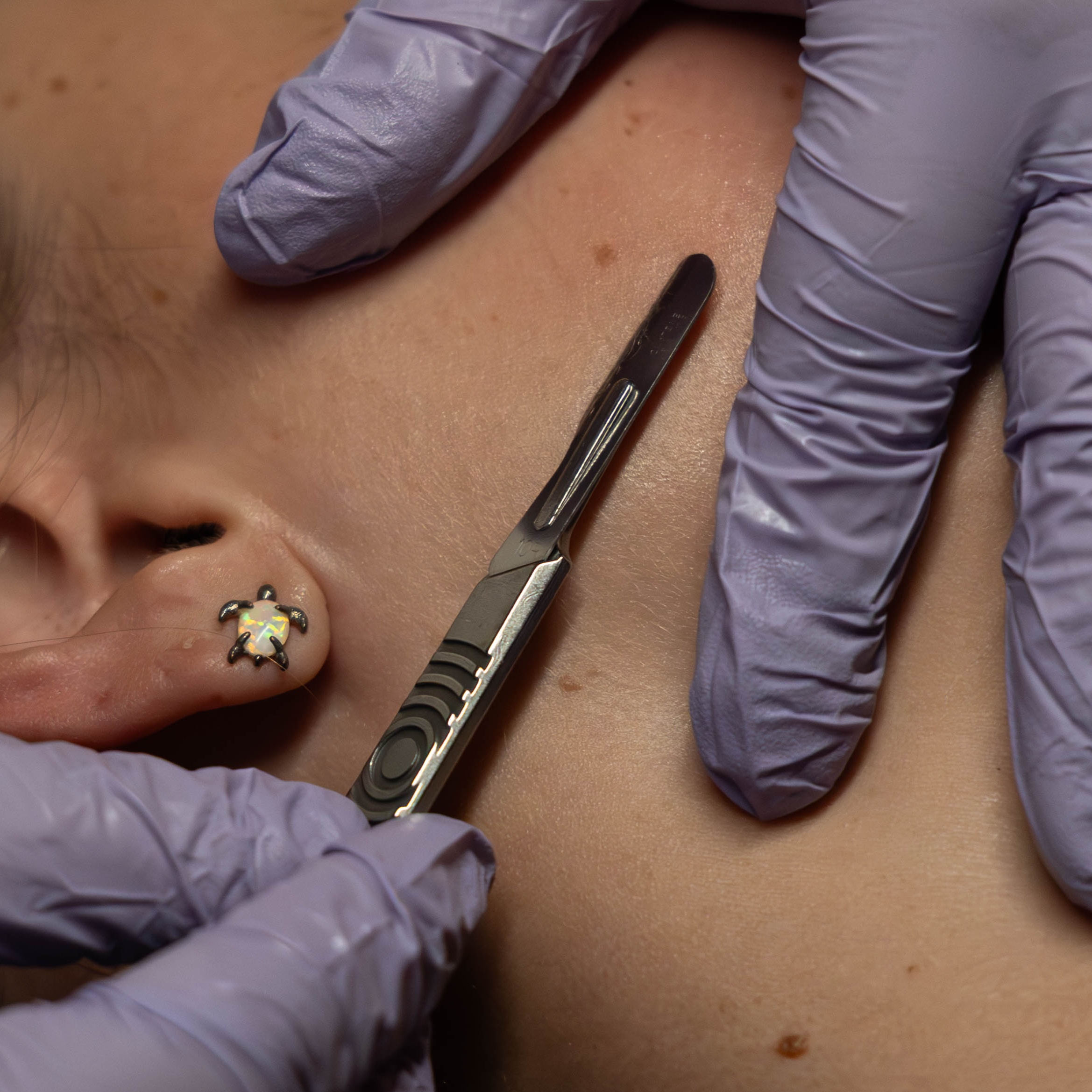 Dermaplane Express (30 Minute) at Cedar & Sage Spa in Bolivar, MO