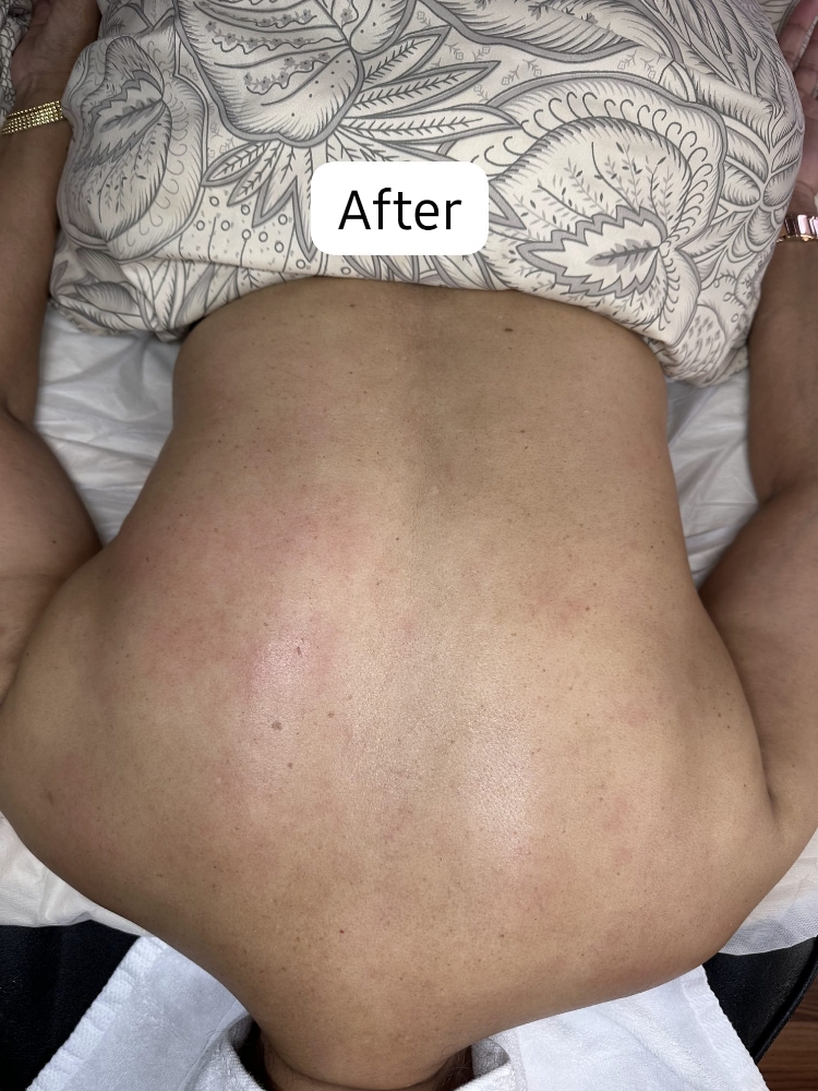 Luxury Back Scrub