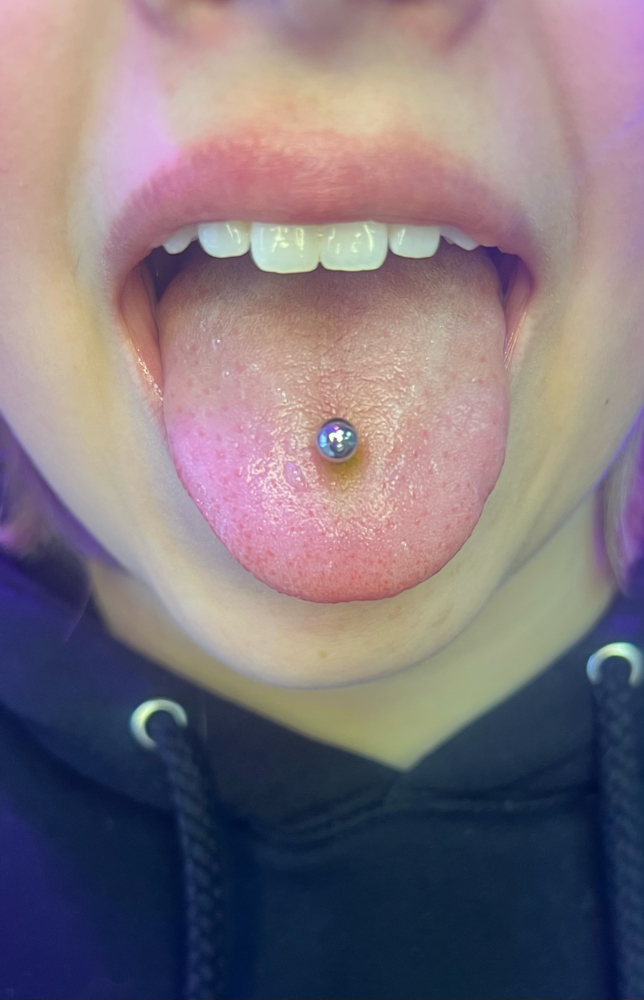 Tongue