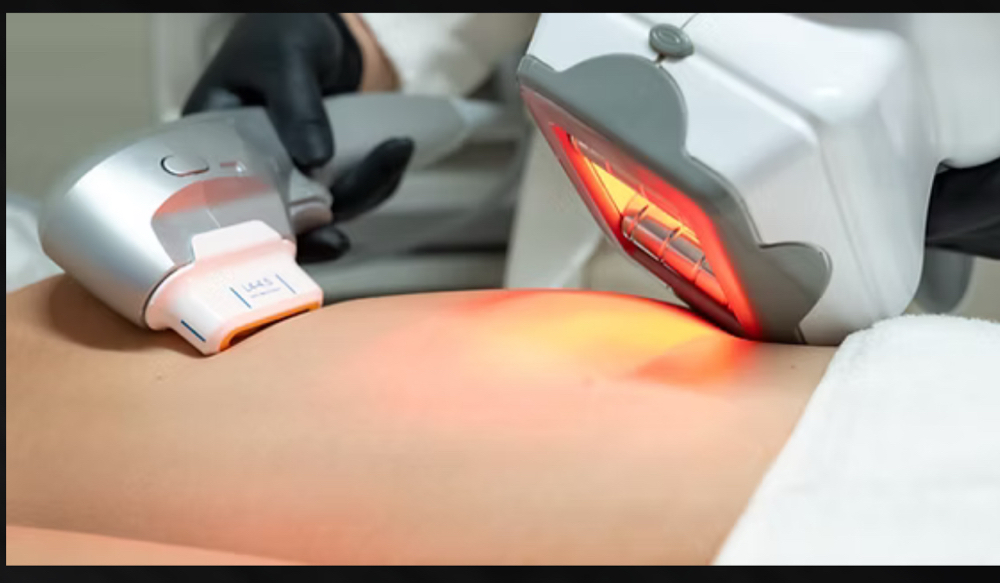 Premium Cellulite Treatment